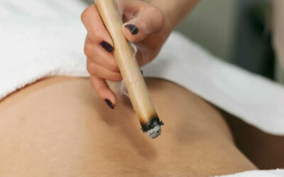 Moxibustion