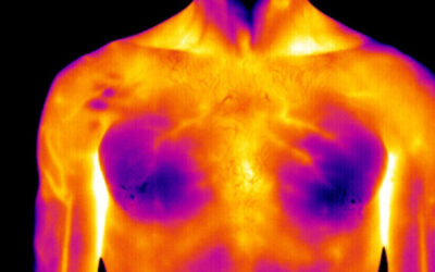Thermographie